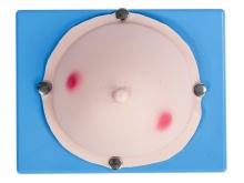 乳腺脓肿检查切开操作模型