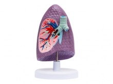 支气管右肺解剖模型
