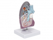 病理肺模型（肺部病变模型）