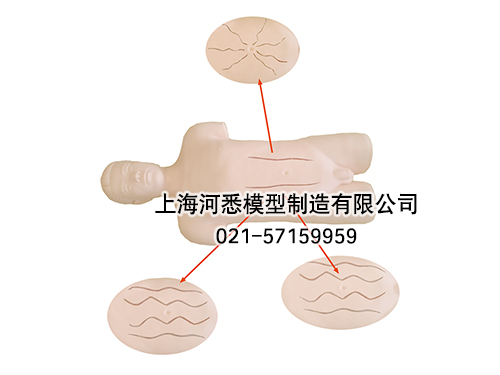 全自动腹壁静脉血流方向检查技能训练标准化病人模型