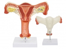 子宫卵巢解剖放大模型