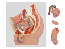 男性盆腔矢状切模型（4部件）
