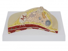 乳房病变模型
