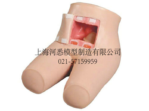 灌肠训练模型
