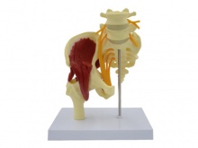腰椎带骨盆附肌肉和坐骨神经模型