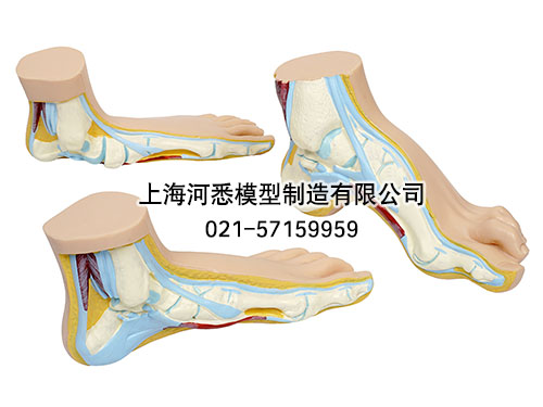 正常足扁平足弓形足模型