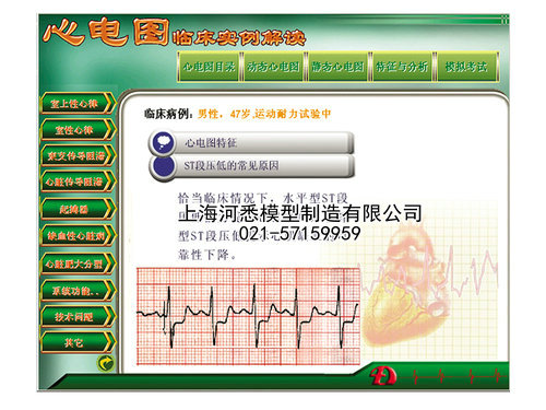 心电图教学与考核软件