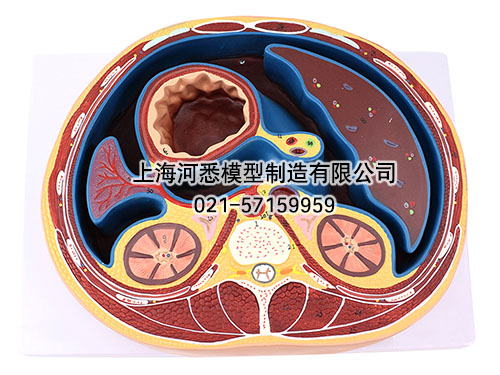 腹腔横断模型