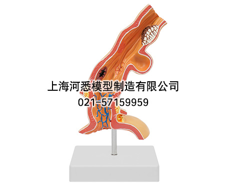 食管疾病模型