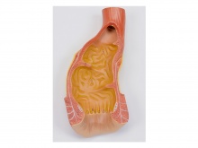直肠内腔模型
