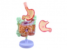 消化系统病变模型（病理肠胃模型）