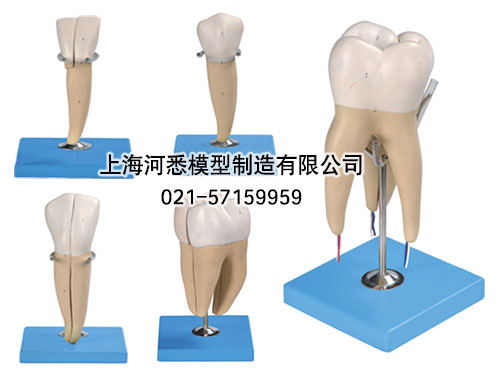 牙放大模型