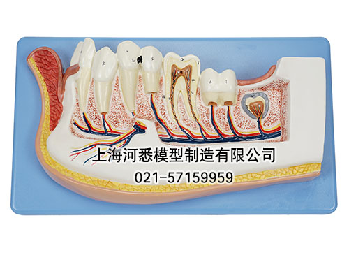 儿童牙列放大模型