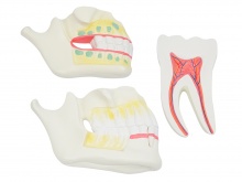 乳牙、恒牙牙列模型