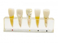 牙体牙髓分类模型